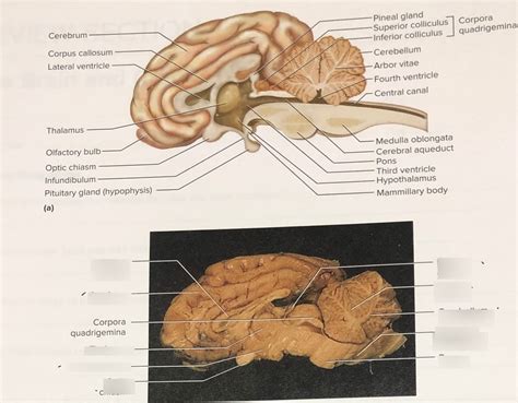 Sheep Brain Pt Diagram Quizlet