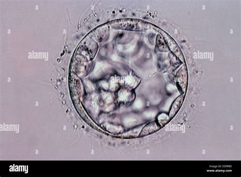 Egg Cell Under Microscope