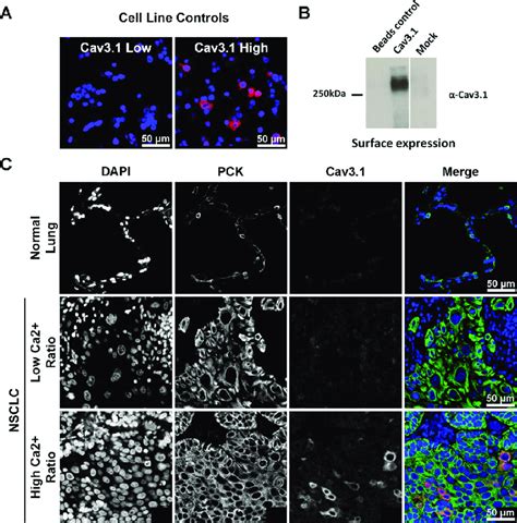 Immunofluorescent Staining For Cav3 1 For Each Panel A Control