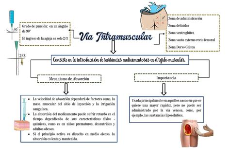 Vía Intramuscular Sara uDocz