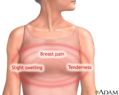 Breast Pain UF Health University Of Florida Health