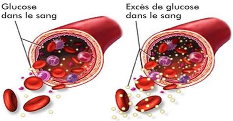 taux de sucre dans le sang Archives Santé Nutrition