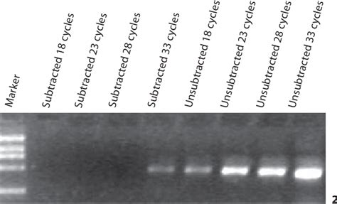 Figure From Suppression Subtractive Hybridization Analysis Of Gene