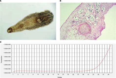 Frontiers Co Infection Of Hepatitis E Virus Clonorchis Sinensis And