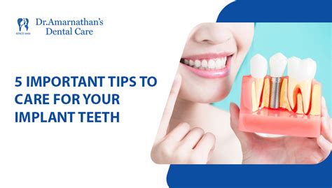 5 Dental Implant Care Tips You Should Know