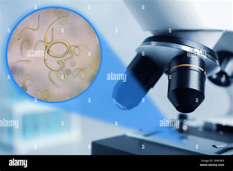 Parasitic worms hi-res stock photography and images - Alamy