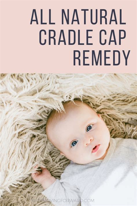 All Natural Cradle Cap Remedy Great Tips For Getting Rid Of Cradle