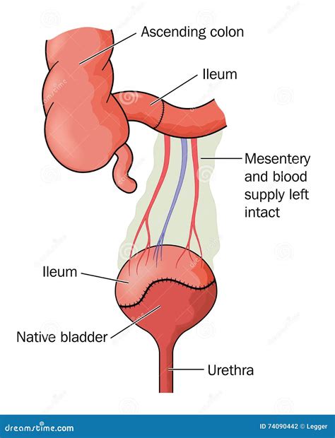 Bladder surgery stock vector. Illustration of human, mesentery - 74090442