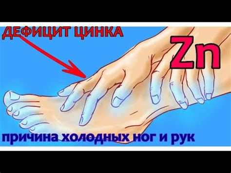 Дефицит ЦИНКА (Zn) - причина ХОЛОДНЫХ рук и ног. КОРАЛ ЦИНК (Коралловый ...