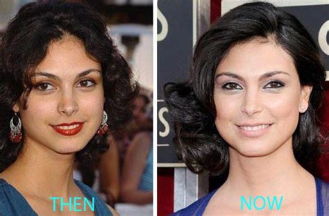 Morena Baccarin Plastic Surgery Before And After Photos - CelebLens.Com