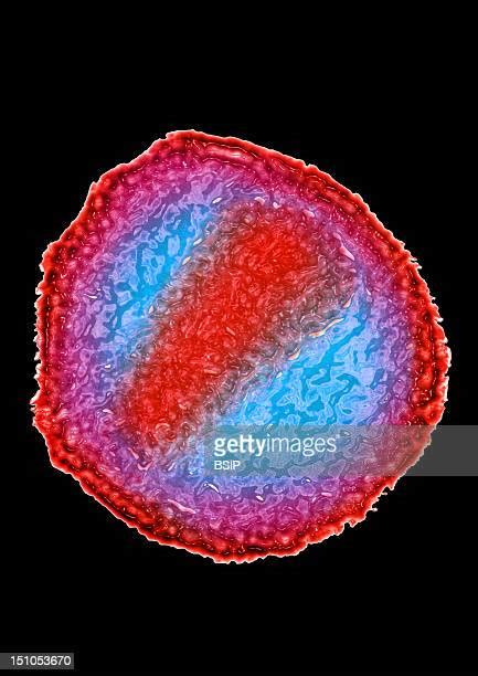 Hiv Virus Microscope Photos and Premium High Res Pictures - Getty Images