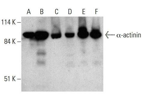 α actinin抗体 H 2 SCBT Santa Cruz Biotechnology