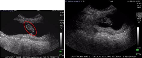 Ibex® Ultrasound Stages Of Early Bovine Pregnancy