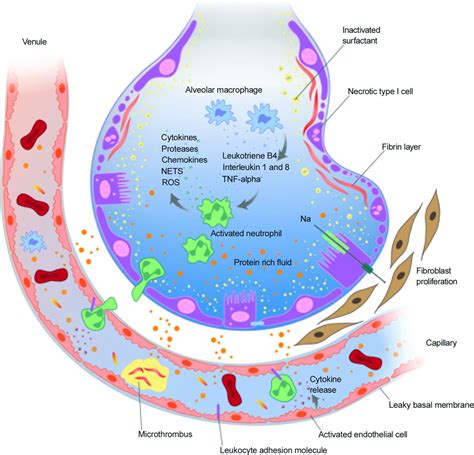 Pulmonary Surfactant