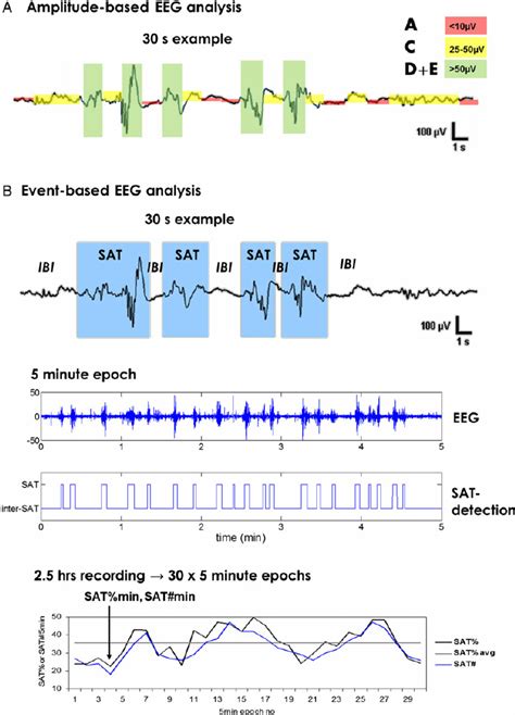 Schematic Presentation Of The Eeg Analysis Paradigms A The