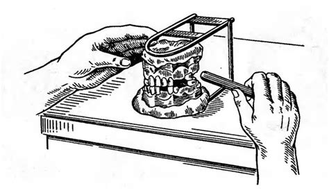 Зуботехнический окклюдатор: виды, цели и особенности применения