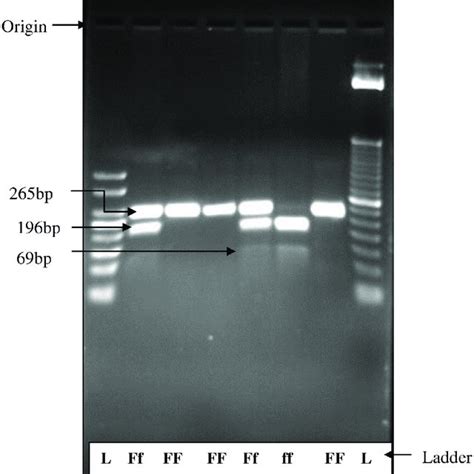 Agarose Gel Electrophoresis For Restriction Fragment Length