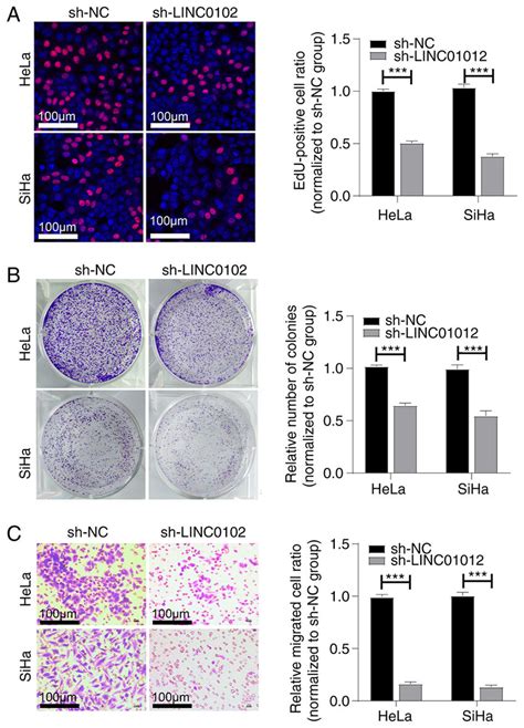 Linc Knockdown Suppresses The Proliferation And Migration Of