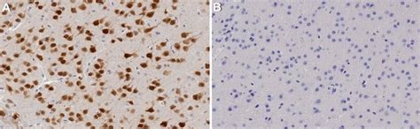 anti neun antibody clone  chemicon mab sigma aldrich