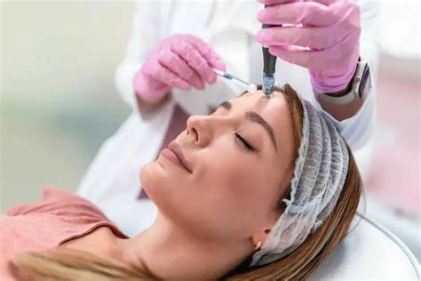 Prepare For Microneedling What You Need To Know