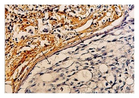 Histochemical Staining With Wisteria Floribunda Agglutinin WFA Of