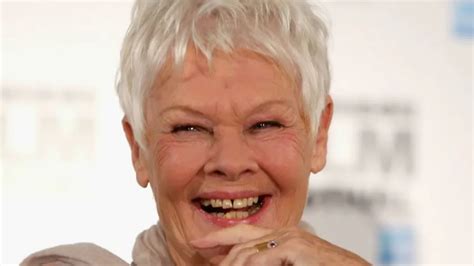 Judi Dench Teeth Before And After 2024