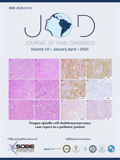 Oral squamous cell carcinoma adjacent to dental implant – a case report