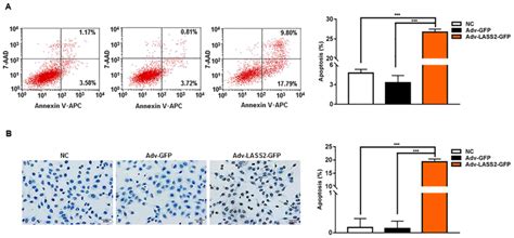 Lass2 Inhibits Proliferation And Induces Apoptosis In Hepg2 Cells By