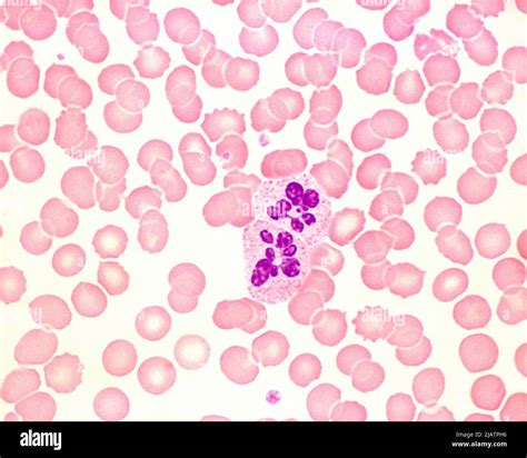 Neutrophil Hypersegmentation Light Micrograph Stock Photo Alamy