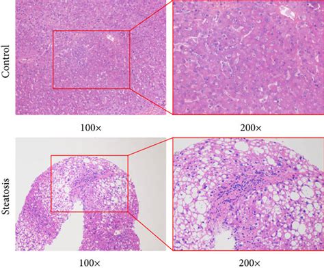 Characteristics of circRNA 0046367 miR 34a PPARα regulatory system in