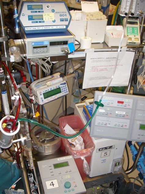 The Ecmo Machine Flickr Photo Sharing