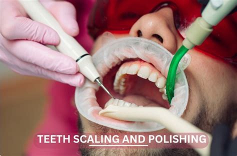 The Benefits Of Teeth Scaling And Polishing Gengimed Dental Clinic