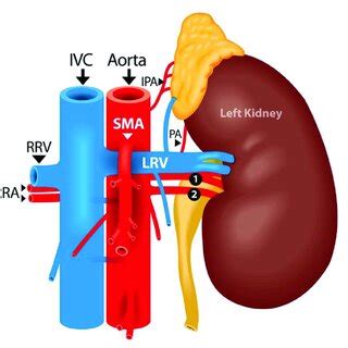 Fullen Anatomic Classification Of Superior Mesenteric Artery 30