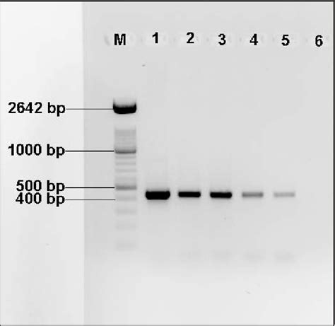 Determination Of The Sensitivity Of The Conventional Pcr With Primers