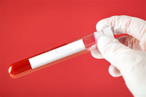 Hand Holding Test Tube With Blood Plasma Ready For Testing Medicine