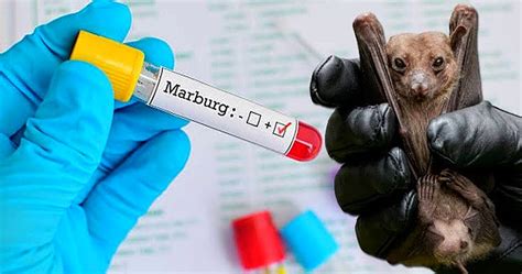 Tanzania Announces End Of Deadly Outbreak Of Marburg Virus - Heritage Times