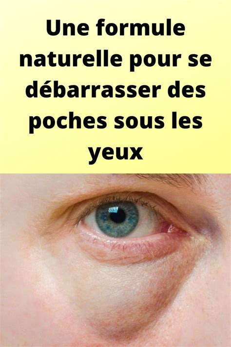 Une Formule Naturelle Pour Se D Barrasser Des Poches Sous Les Yeux