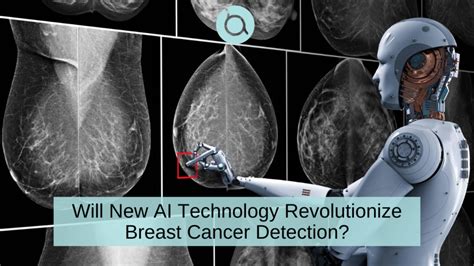 AI May More Accurately Predict Breast Cancer Risk Breast Advocate App