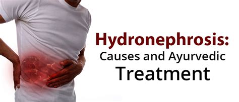 Hydronephrosis: Causes and Ayurvedic Treatment