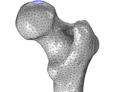 Generating A Simulation Mesh Of A Femur From 3d Data Comsol Blog