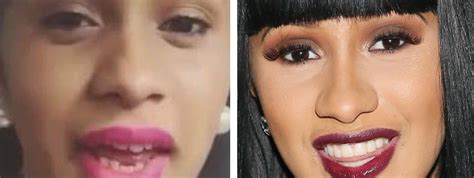 Did Cardi B Get Her Teeth Fixed? See Before-and-After Pictures