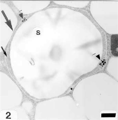 An amyloplast with its double membrane (large arrow) enclosing a ground ...