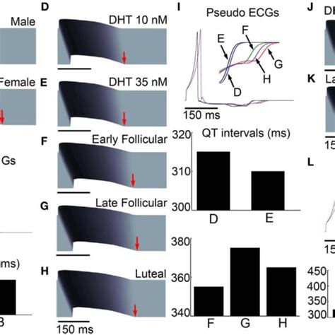 Sex Based Differences In Human Cardiac Ion Channels Altered Myocyte