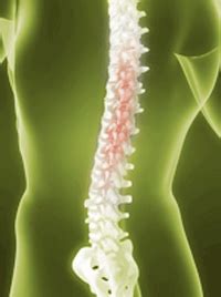 Spinal Misalignment Burlington Natural Health Chiropractic Massage