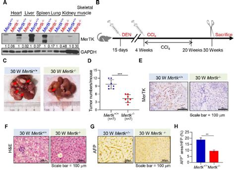 Deletion Of Mertk Inhibits Den And Ccl Induced Hcc Formation A