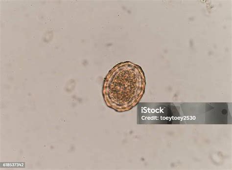 Telur Cacing Nematoda Parasit Ascaris Lumbricoides Foto Stok Unduh Gambar Sekarang Istock