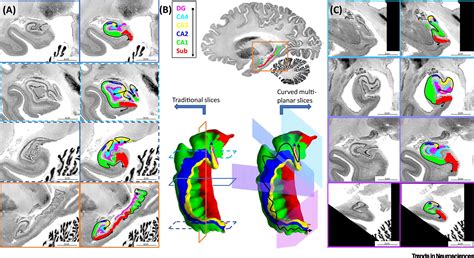 Surface Based Hippocampal Subfield Segmentation Trends In Neurosciences