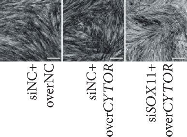 Cytor Promotes Osteogenic Differentiation Of Pdlscs Through Regulating