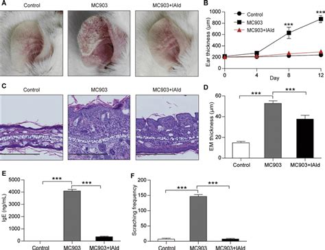 Topical IAId Attenuated MC903 Induced AD Like Dermatitis Of Mice