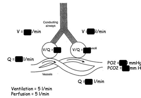 Lecture 15 Ventilation And Perfusion Matching Flashcards Quizlet